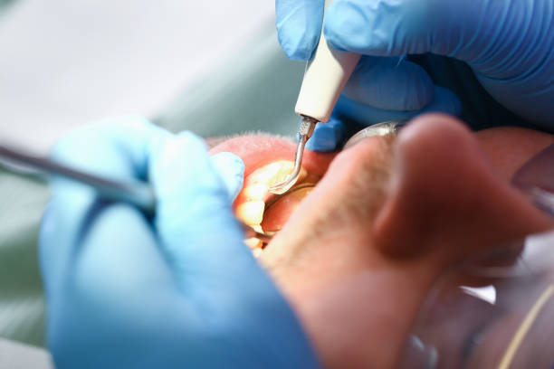 Best Root Canal Emergency Dentist  in Elysburg, PA