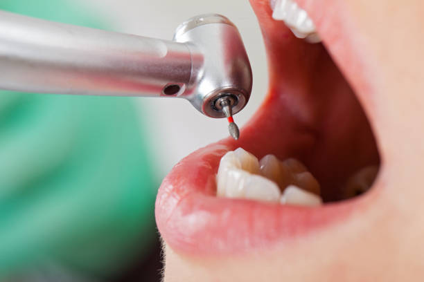 Best Chipped Tooth Repair Near Me  in Elysburg, PA